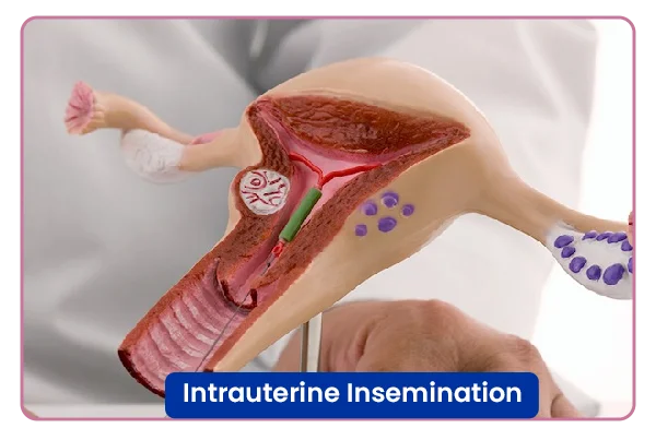 Intrauterine Insemination