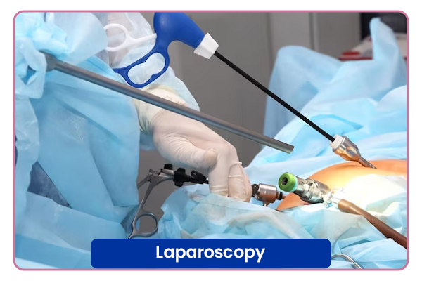 Laparoscopy Surgery